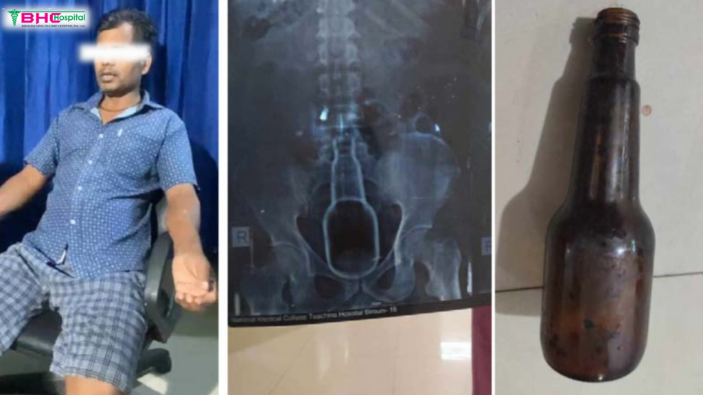 When a glass bottle was found in the young man’s stomach